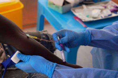 Inside the study for a remedy to fight Congo’s deadliest Ebola outbreak