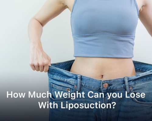 How Much Weight Can you Lose With Liposuction