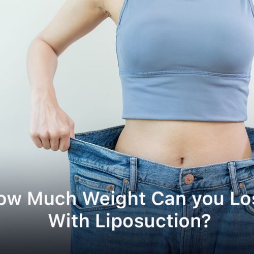 How Much Weight Can you Lose With Liposuction